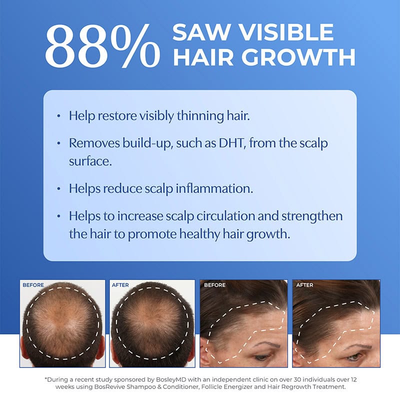 Bosley Revive for Non-Coloured Visibly Thinning Hair Starter Pack, 3 Pieces - Image 4